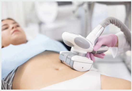 Woman receiving non-invasive body contouring treatment on abdomen with modern device